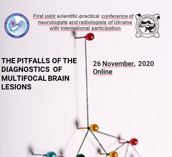 The pitfalls of the diagnostics  of multifocal brain lesions